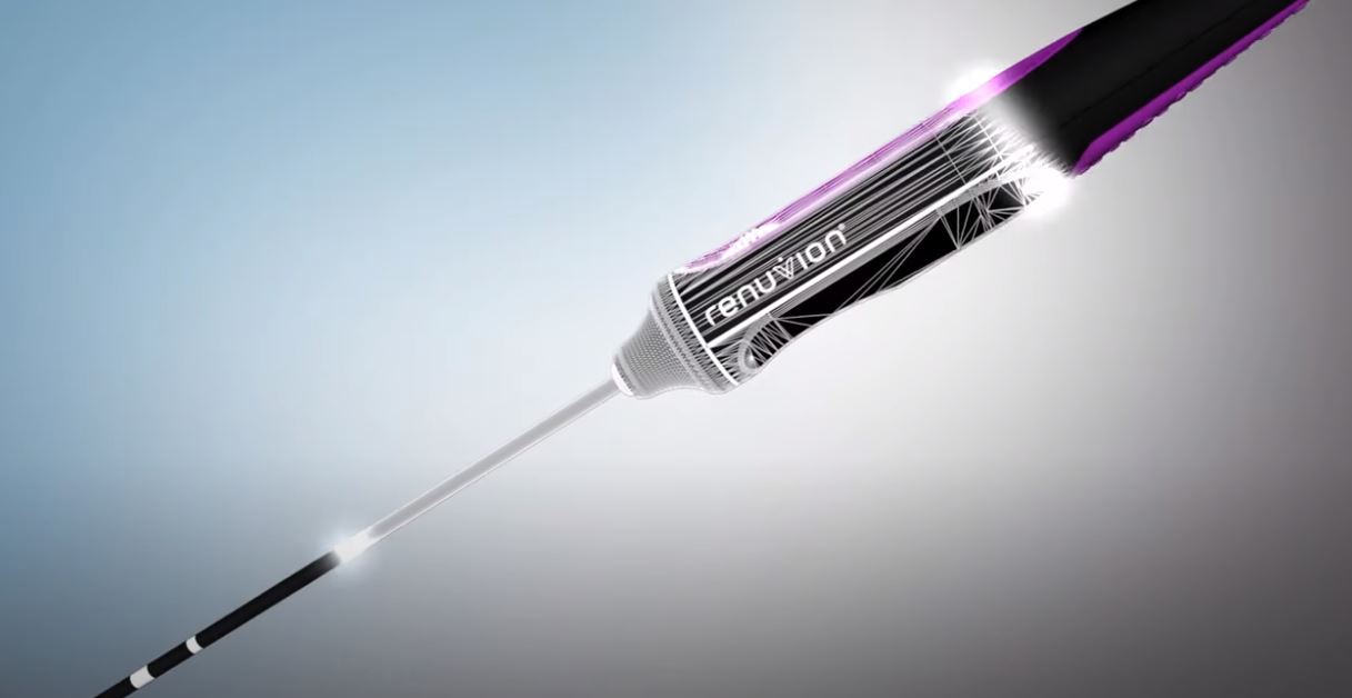 renuvion jplasma